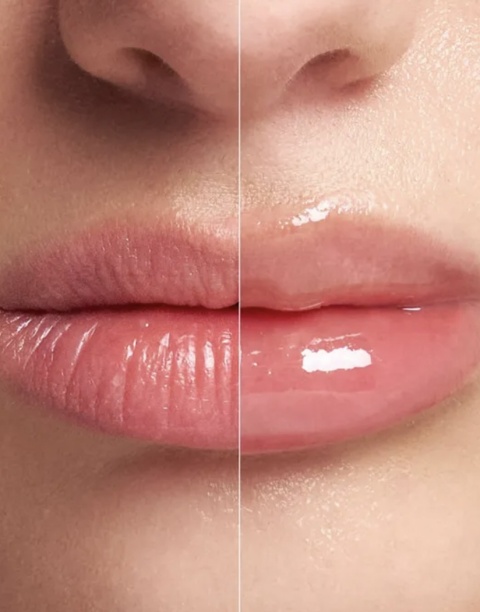 VT Cosmetics - Reedle Shot Lip Plumper For Expert - 4.3g