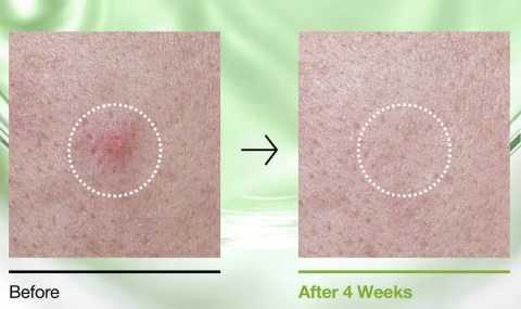 ANUA - Azelaic Acid 3 Cica Skin Clarifying Toner - toner oczyszczający z kwasem azelainowym i wąkrotą azjatycką- 250ml